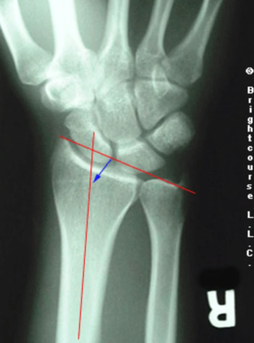 <p>What angle is being assessed in this image?</p>