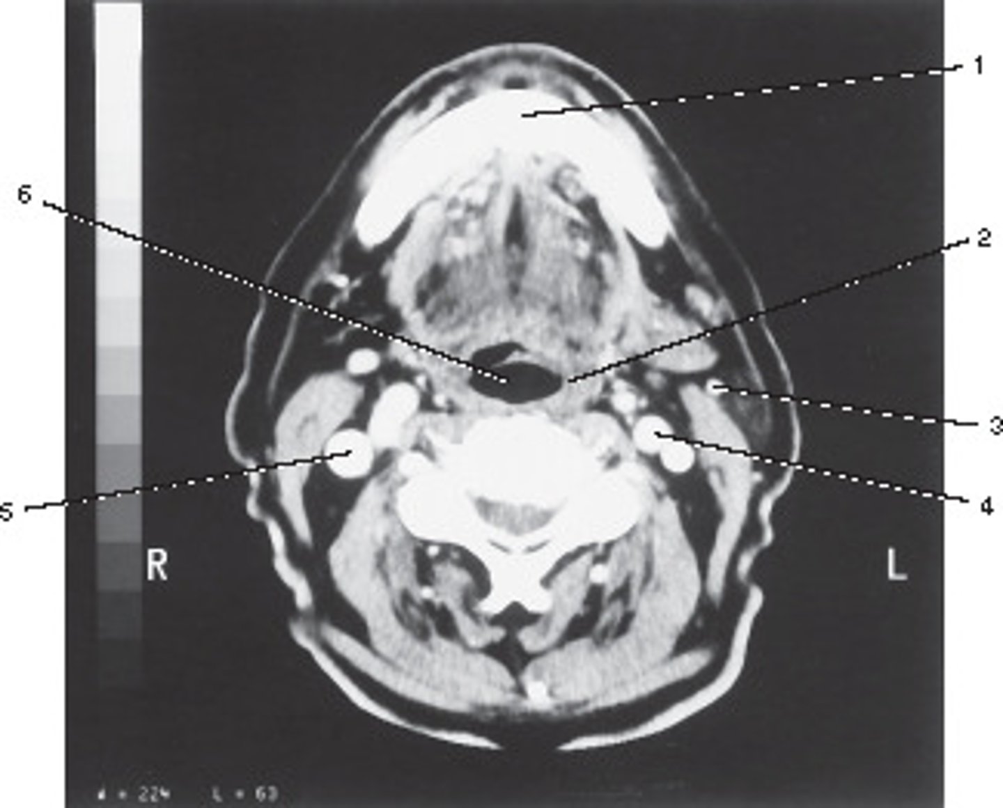 <p>Number 6 corresponds to which of the following?</p>