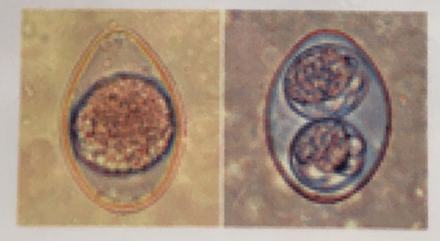 <p>can have figure 8</p>