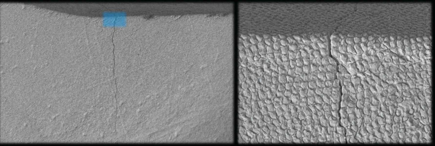 <p>if enamel rods were all parallel into inner surface then whole tooth would break so thats why inner surface goes into dif directions to block the crack from propogating</p>