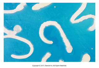 <p>Unique in that larval stage is strobilocercus​</p><ol><li><p>Rodents ingest hexacanth eggs from cat feces, develop into cysticercus inside liver for 42 days​</p></li><li><p>On day 42, cysticercus changes shape into strobilocercus with scolex and long neck attached to bladder (Cysticercus fasciolaris)​</p></li><li><p>Cat infected by eating rat or mouse liver​</p></li><li><p>Scolex attaches to cat intestine</p></li></ol><p></p>