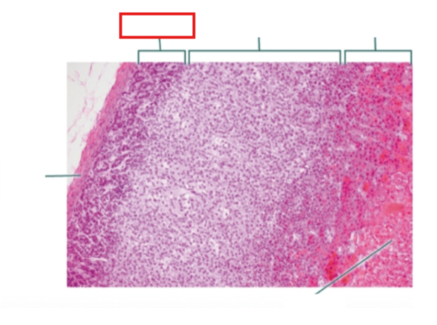 <p>What structure is highlighted?</p>