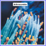 <p>Example of Arthroconidia </p>