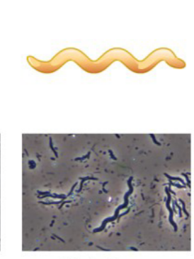 <p>What type of bacteria is this? </p>