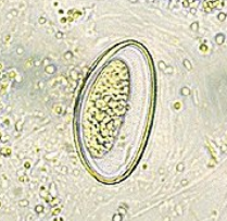 <p>Sobre o(s) ovo(s) na foto, escreva:</p><ul><li><p><strong>NOME CIENTÍFICO</strong> da espécie de parasito</p></li><li><p><strong>FORMA EVOLUTIVA</strong> (+ <strong>SEXO</strong> - <u>se houver</u>)</p></li></ul>