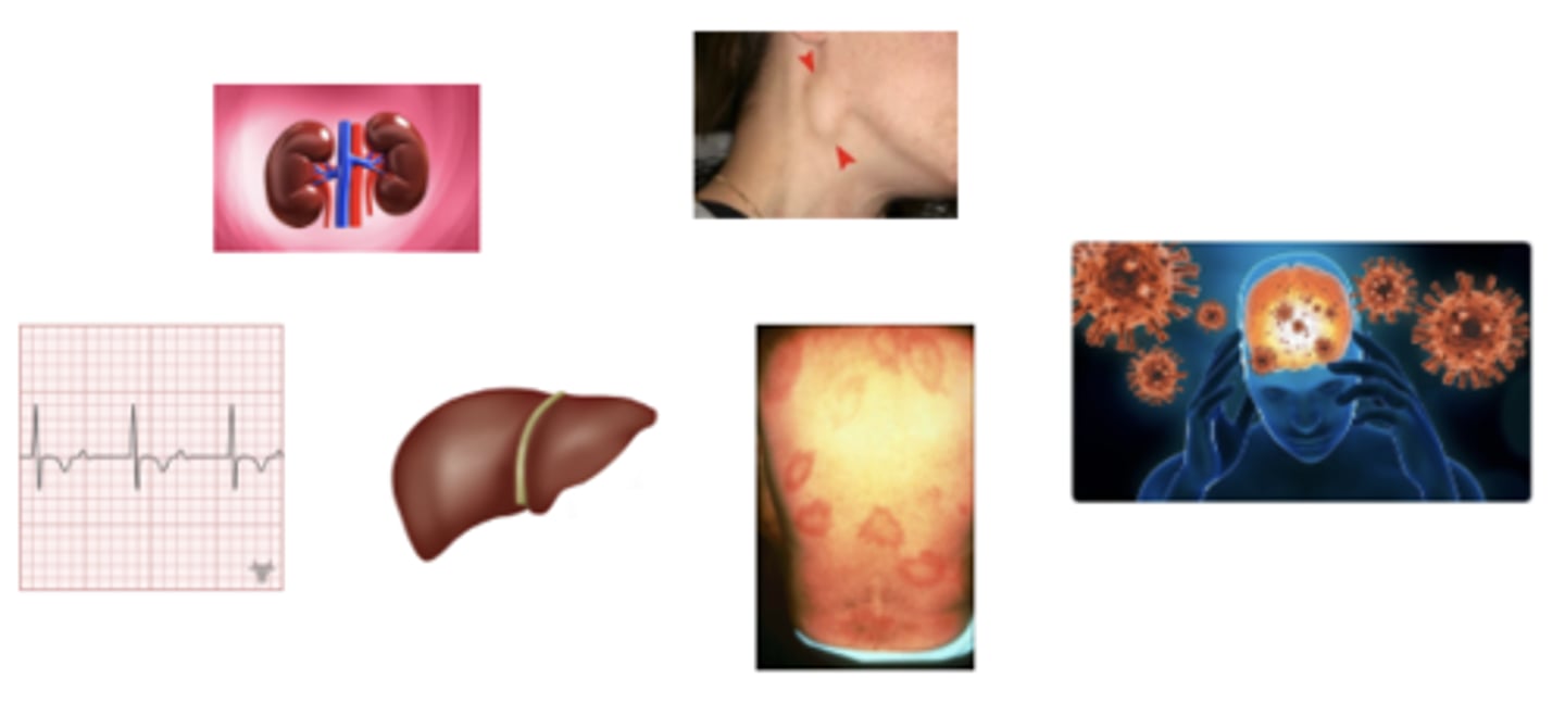<p>what stage of lymes disease is this</p>