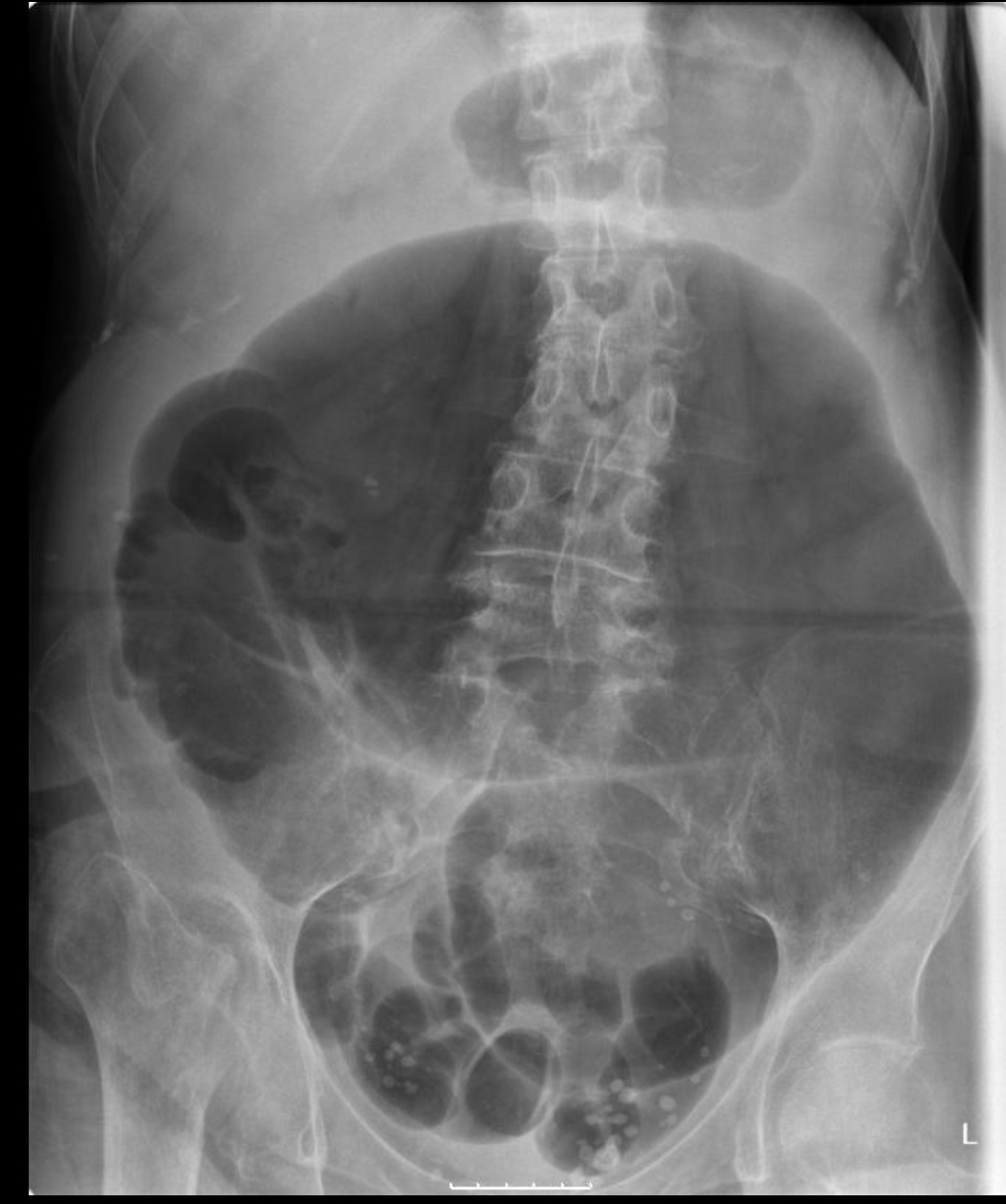 <p>What pathology is this?</p>
