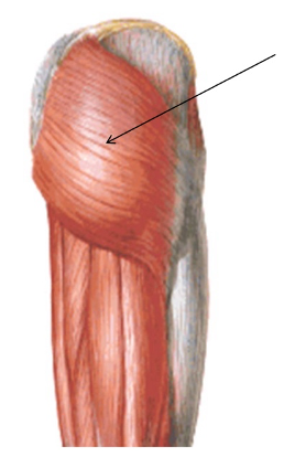 <p>What is the insertion of this muscle?</p>