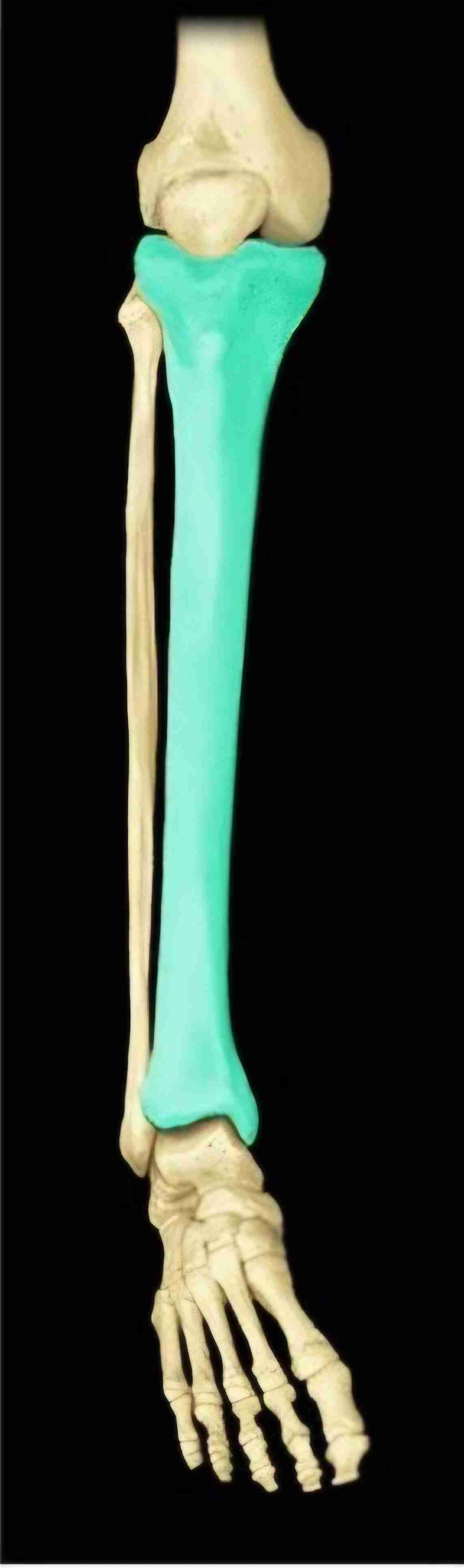 <p>What bone is this?</p>