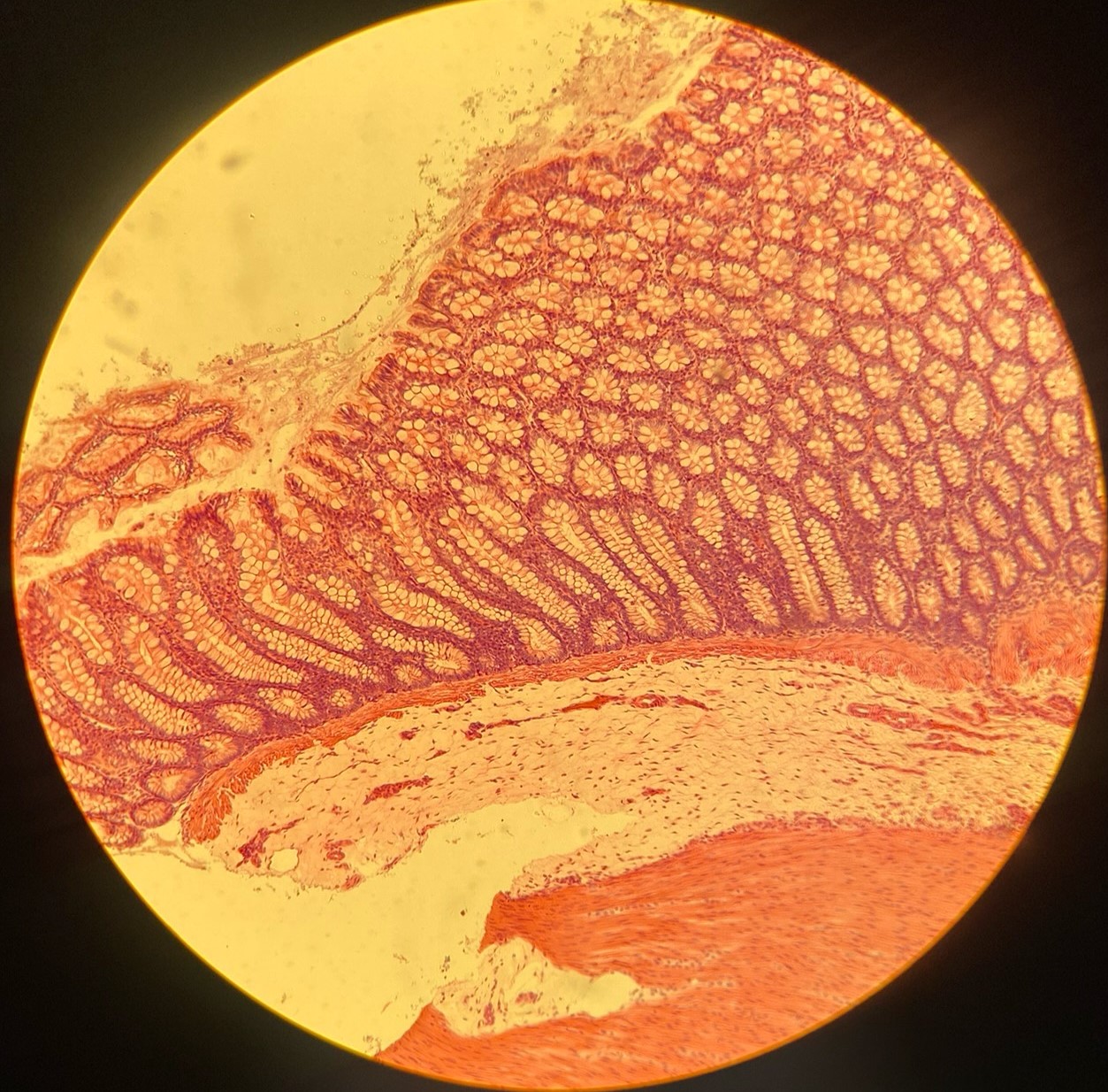 <p>example: digestive tract<br>function: secretion of mucous/ absorption<br><br>a single layer thick; tall, column-like</p>
