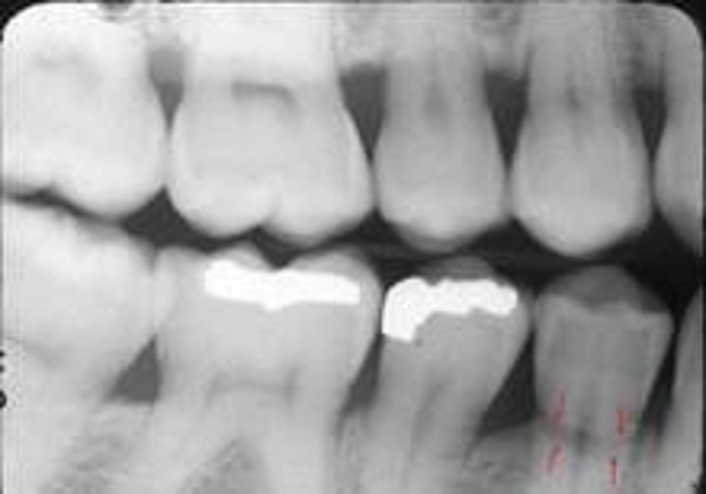 <p>adv /rɪˈpet.ɪ.tɪv.li/ một cách lặp đi lặp lại (tiêu cực ), thường nói đến sự nhàm chán để tới mức có AI làm thay thế cho con người ở việc làm đó</p><p>Question 3: B. repetitively (as an option for topped ratings)Câu 3: B. repetitively (làm lựa chọn cho dẫn đầu xếp hạng)</p>