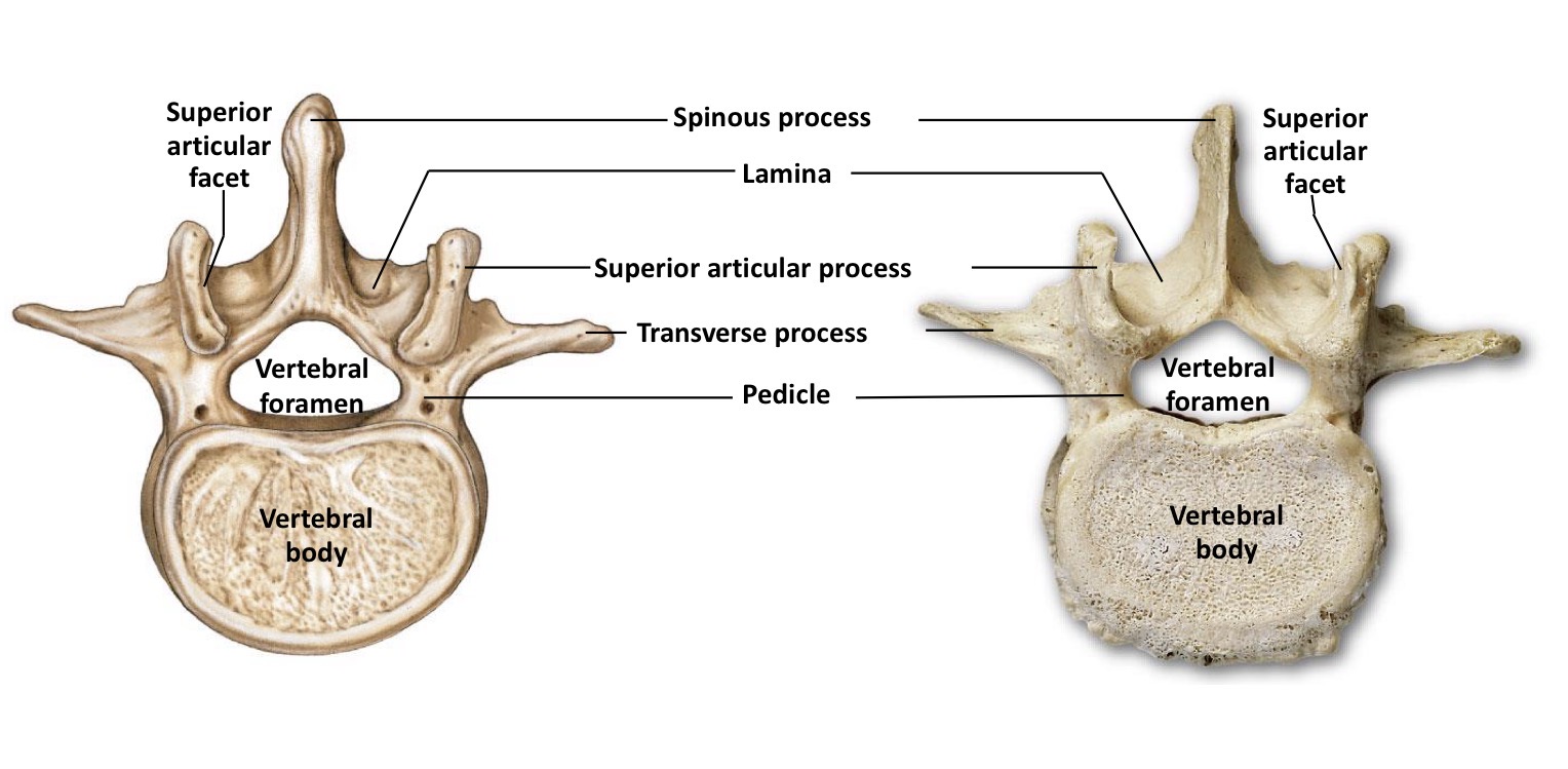 <p>The largest vertebrae that support the weight of the upper body, characterized by large bodies and lack of transverse foramina, costal facets, or bifid spinous processes </p>