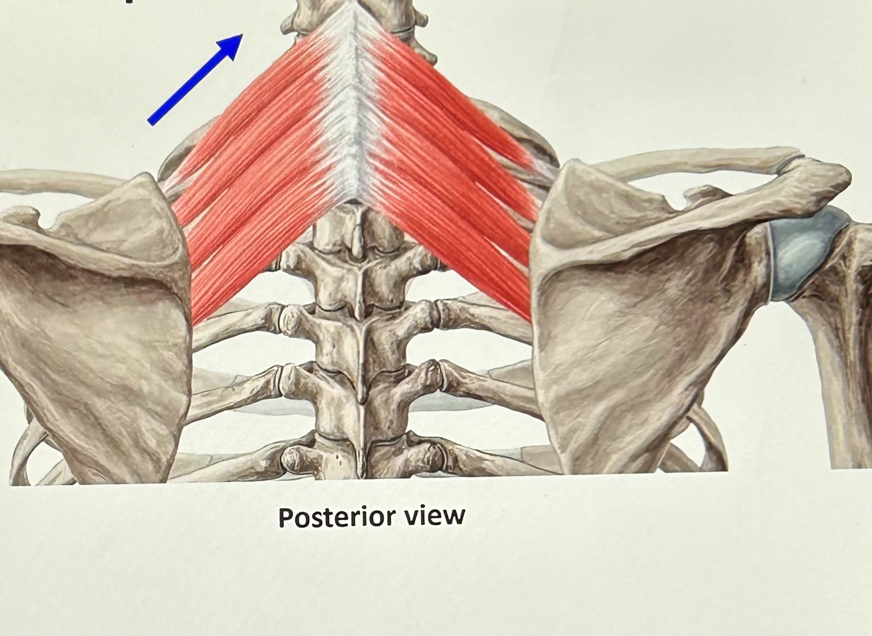 term image