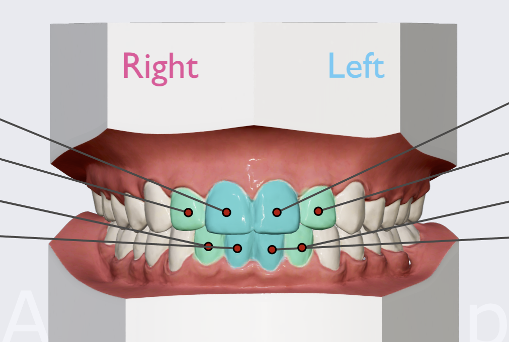 <p>Name the teeth highlighted in blue and teal.</p>