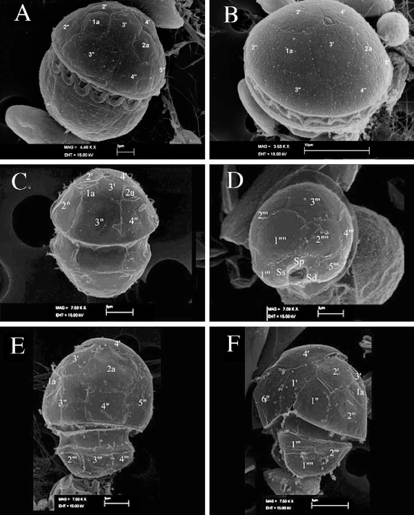 <p>What is the significance of this group of dinoflagellates?</p>