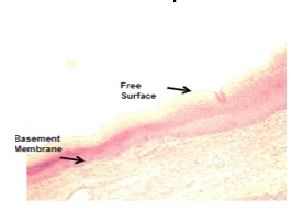 <p>structure: many layers with outermost layer being flat and scale-like, underlying layers more cuboidal or columnar</p><p>location: anyway the outer layers can be abraded and generally wherever protection is needed</p><ul><li><p>epidermis of skin, inside oral cavity, esophagus, vaginal canal</p></li></ul><p>function: protection against abrasion, keratin also acts as waterproofing agent</p>