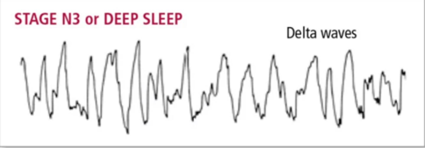 <p>(C) N3</p><p>N3 is a stage of sleep that is characterized by slow wave sleep and delta waves become present on an EEG.</p>