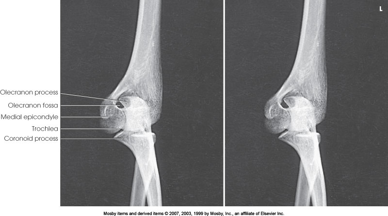 <p>What position is demonstrated?</p>