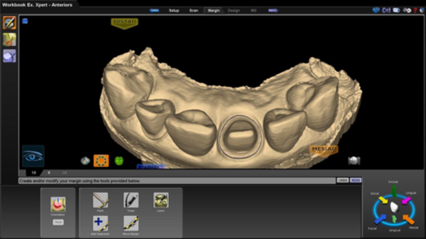 <p>If you want to take digital impressions, what must you still expose?</p>
