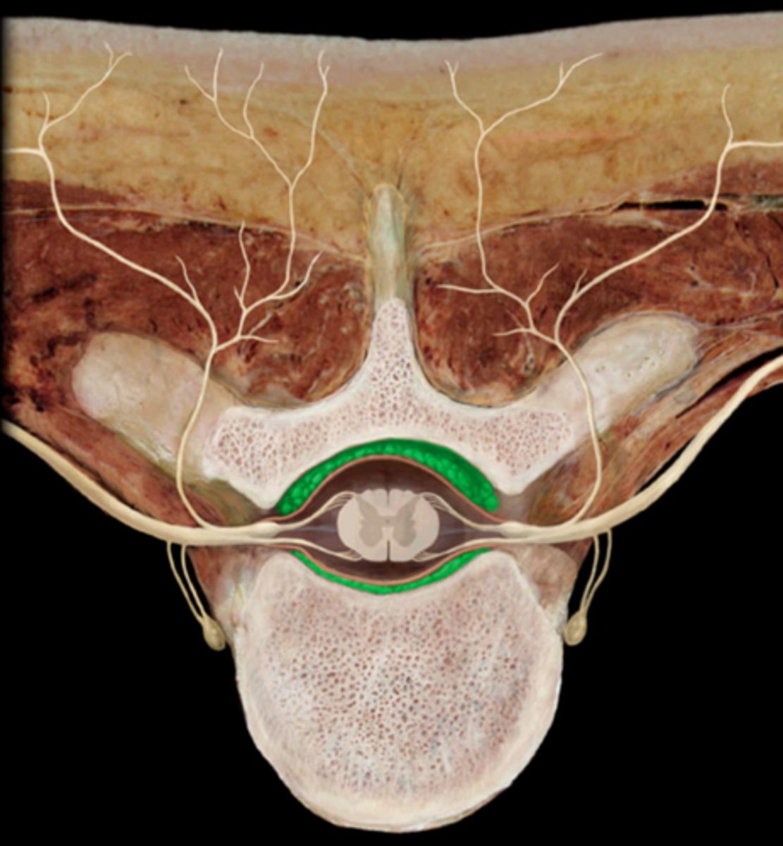 <p>Space. will stick probe up under vertebrae/ above dura mater</p>