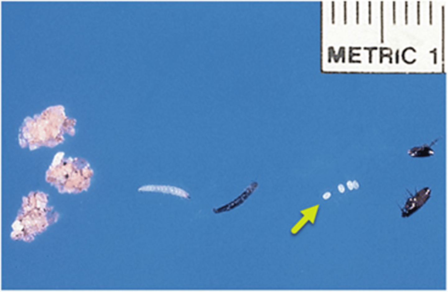<p>The yellow arrow is pointing to the ________ life cycle stage of the flea.</p>