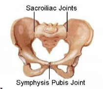 <p>Fused joint: Sacroiliac joint</p>