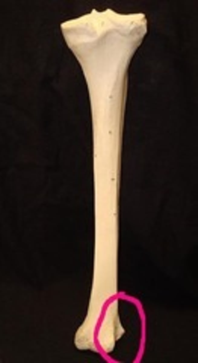 <p>wide groove on the lateral side of the distal tibia for articulation with the fibula at the distal tibiofibular joint</p>