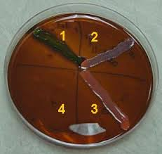 <p></p><p><span>differentiating between E. coli, lactose-fermenting, and non-lactose-fermenting gram-negative bacteria based on their colony appearance; fecal contamination confirmatory test</span></p>