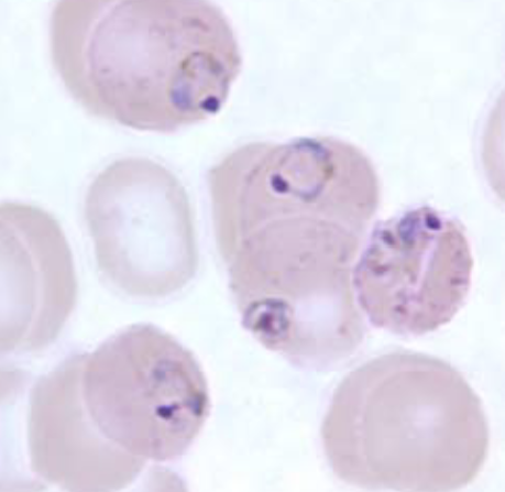 <p>What plasmodium species is this? How can you tell?</p>