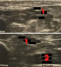 <p>Label the vessels crossed out on the image. </p>