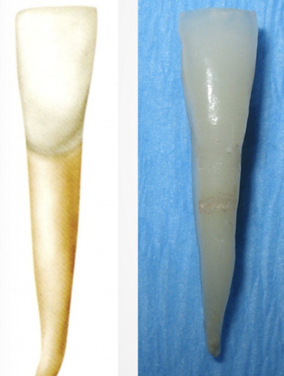 <p>- Narrowest Mesial to distal (mesiodistally) of all incisors</p><p>- Shortest tooth in dentition</p><p>- Bilaterally symmetrical</p><p>- M and D profiles of tooth taper evenly from incisal edge to apex</p>