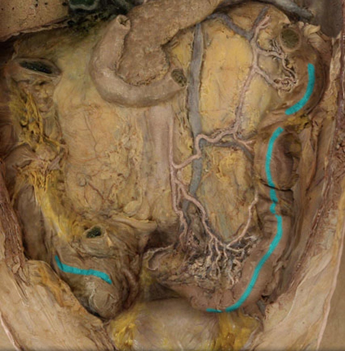 <p>What is this?</p>