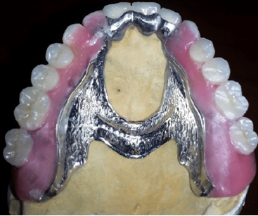 <p>Pelots RPD</p>