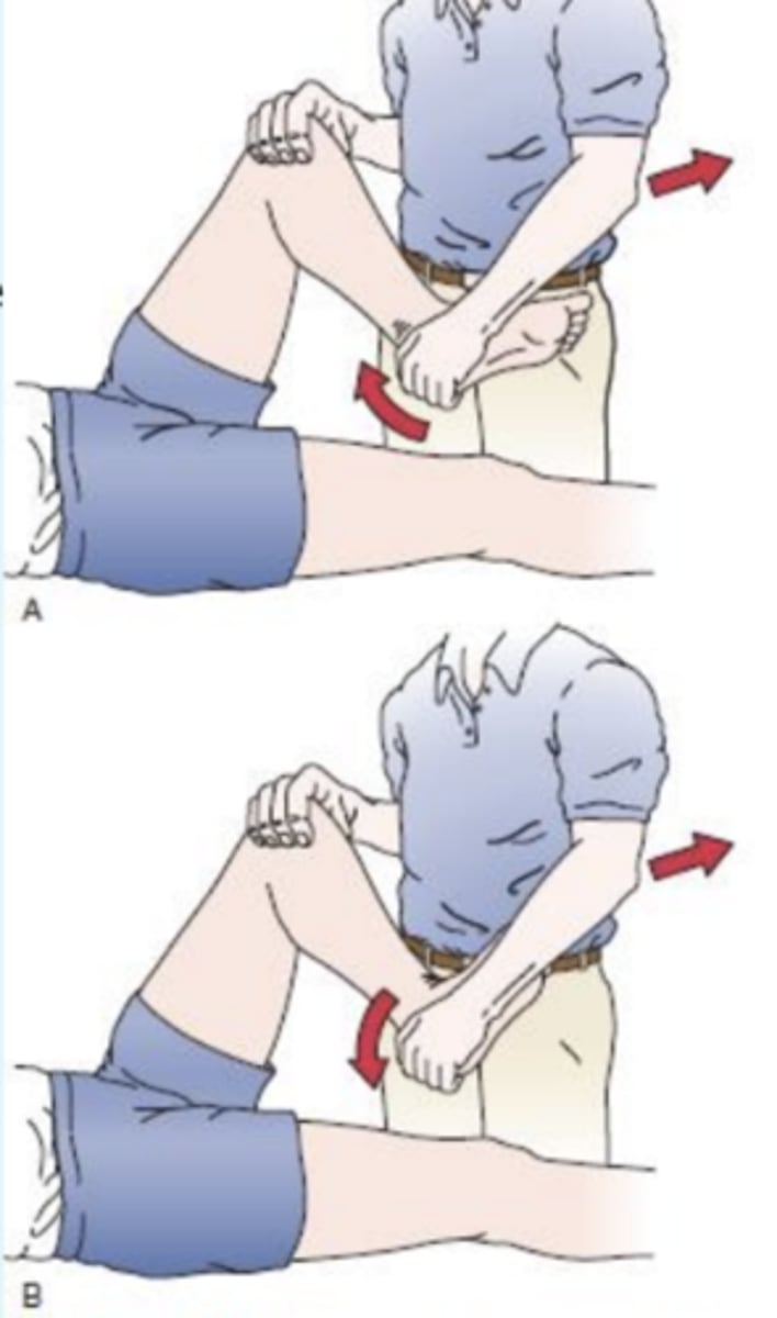 <p>- meniscal tears</p><p>description: pt lies in supine with knee completely flexed (heel to the buttock). the PT then medially rotates the tibia and extends the knee.</p><p>(+): if there is a loose fragment of lateral meniscus, this action causes a snap or click, with pain</p><p>test medial meniscus with same procedure except rotate tibia into lateral rotation =</p>