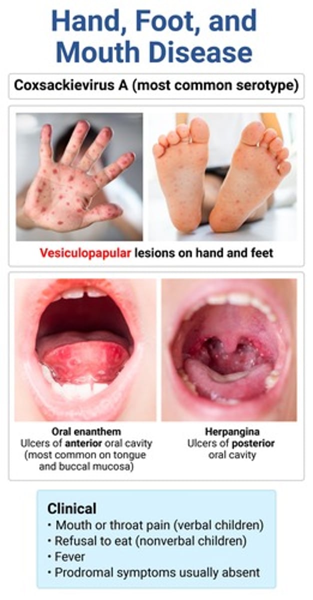 <p>HFMD → typically resolves in 1 wk</p>