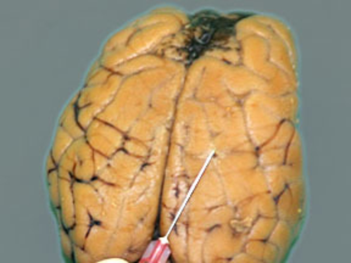 <p>thin, delicate inner membrane of the meninges</p>