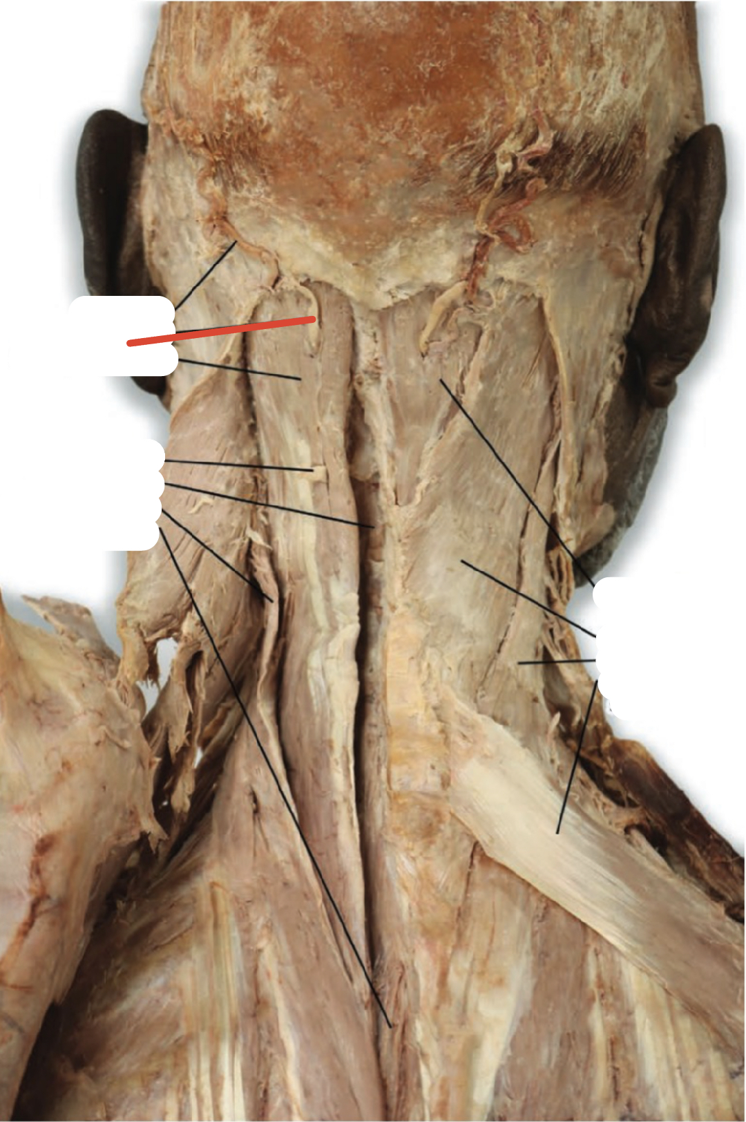 Identify the structure (red line)