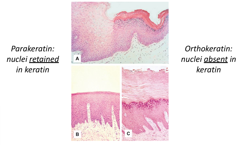<p>-family of intermediate filament proteins present in epithelial cells (keratinocytes)</p><p>-cell level: key component of cytoskeleton</p><p>-organ level: barrier function</p><p>-54 functional keratin proteins</p><p>-orthokeratin and parakeratin: describes microscopic appearance of keratin</p><p>-dyskeratosis: abnormal intracellular keratinization</p>