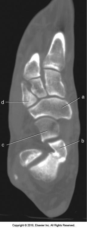 <p>A</p>