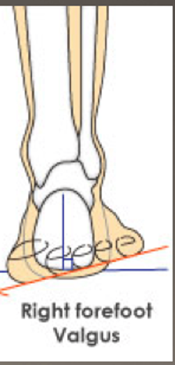 <p>- eversion of forefoot</p><p>- subtalar joint in neutral</p>