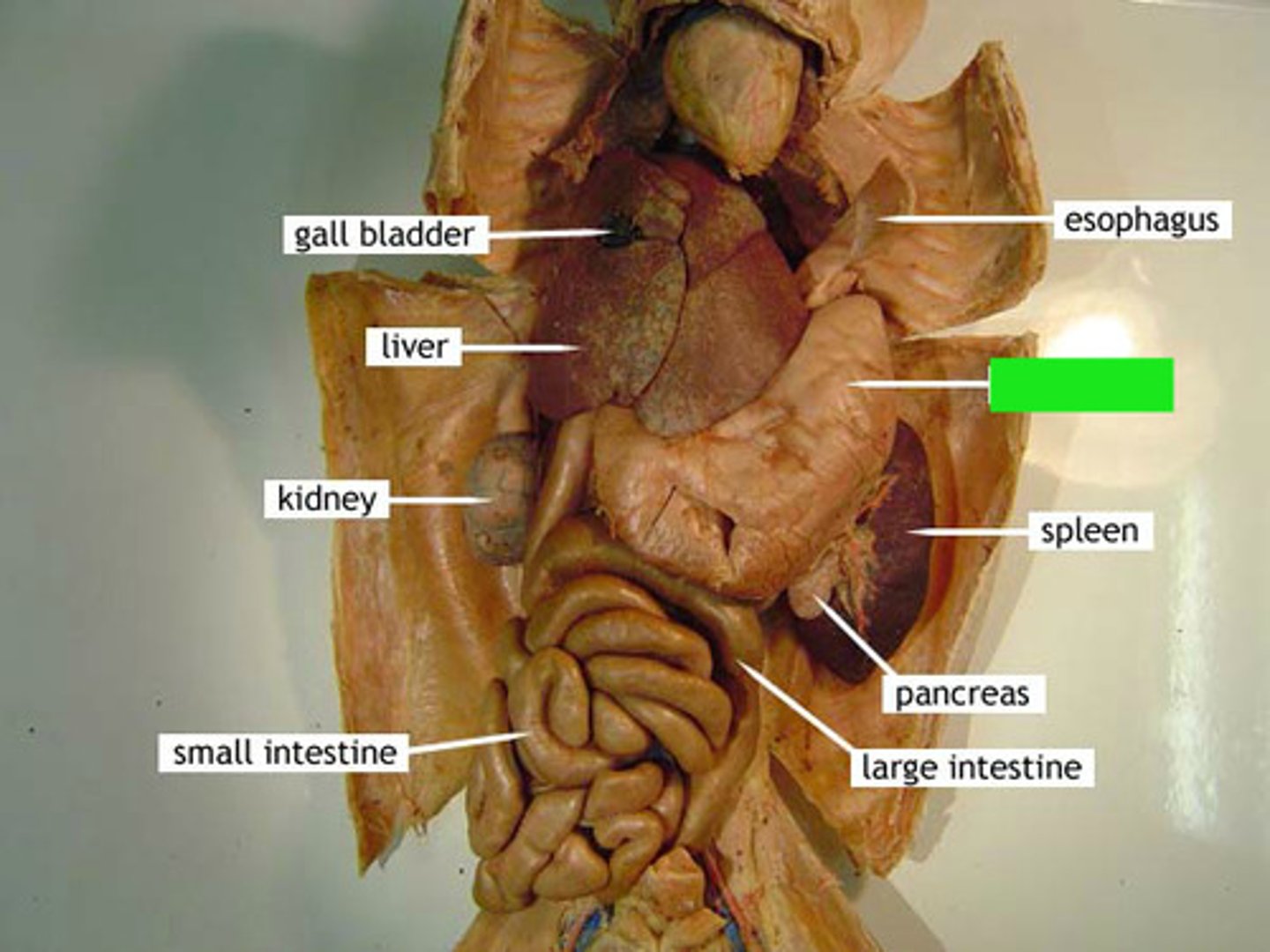 <p>Identify the structure at the green pointer box.</p>