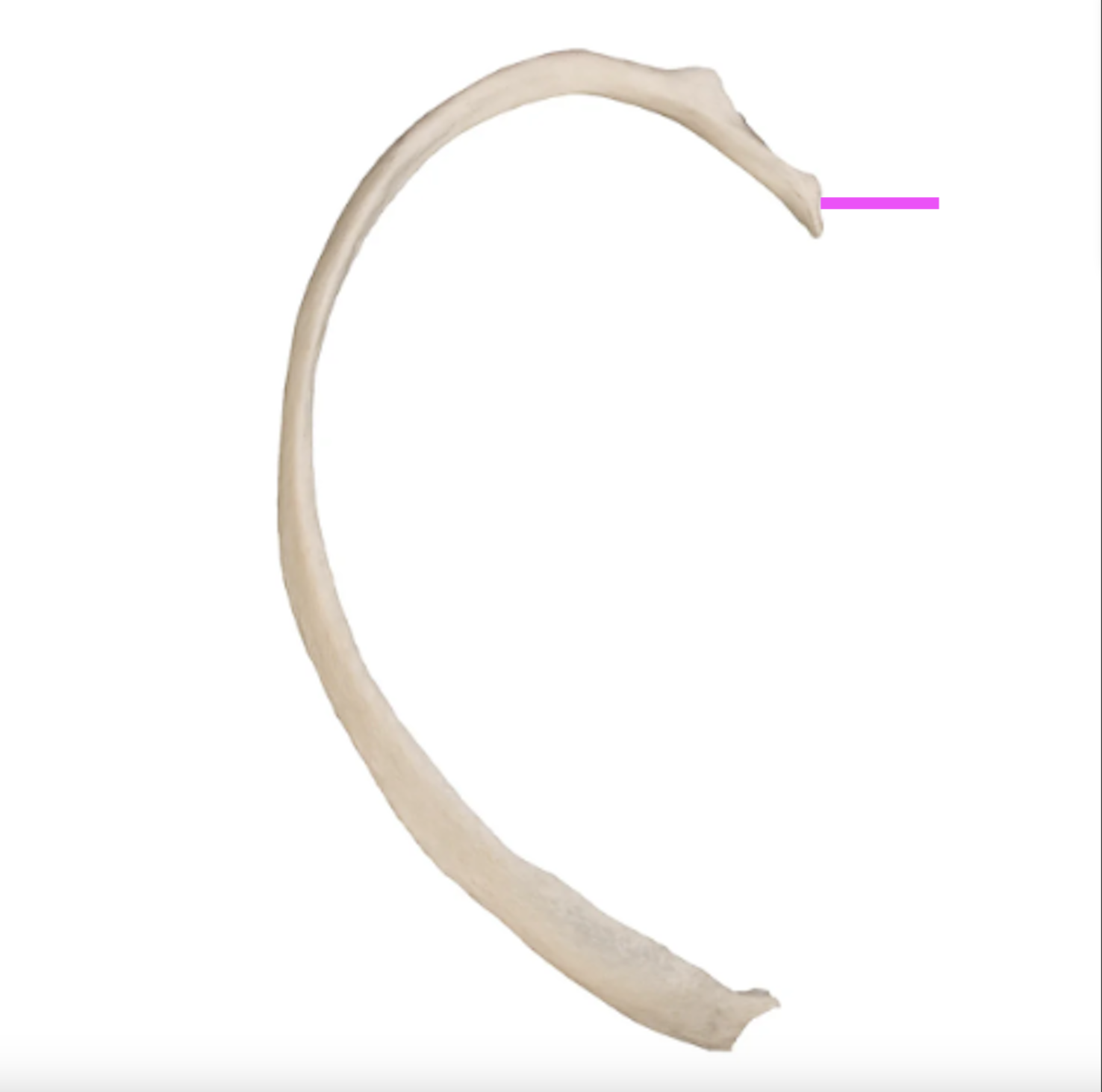 <p>What part of the rib is this?</p>
