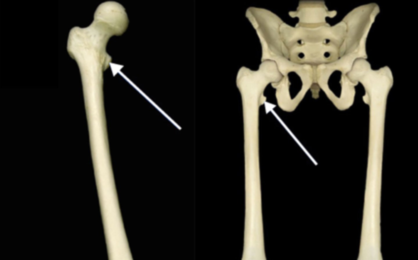 <p>smaller prominence inferior to the head on the medial side of the femur</p>