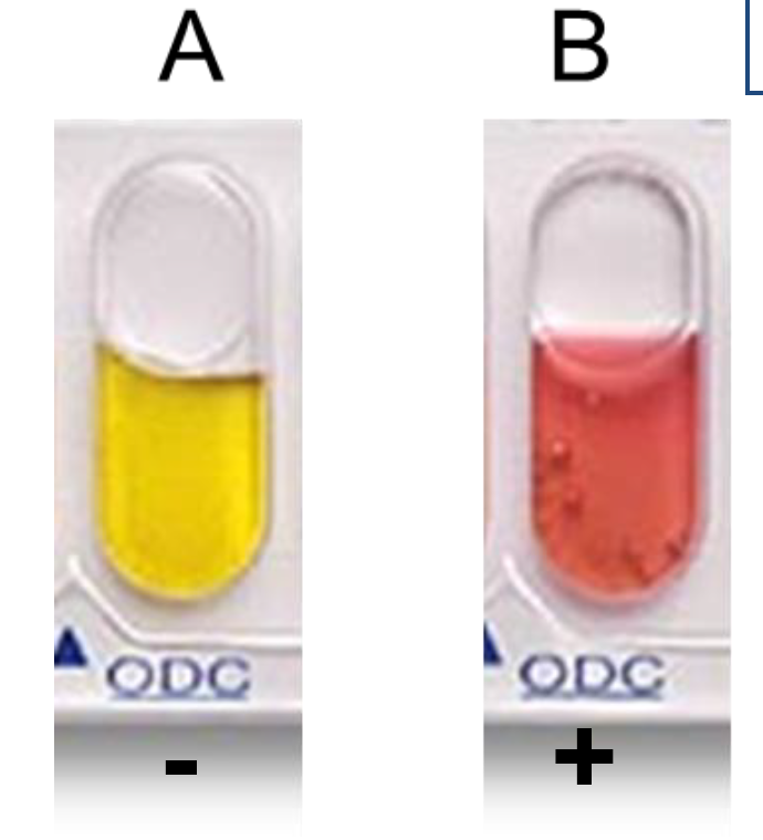 <p>Ornithine Decarboxylation </p><p>Determine whether bacteria can decarboxylate ornithine by ornithine decarboxylase</p>