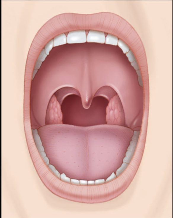 <p>different types of tonsils and their locations?</p>