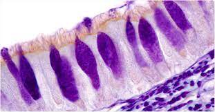 <p>specialized epithelial cells found in the respiratory and digestive tracts. They are named after their goblet-like shape, with a narrow base and a wide, rounded top. These cells produce and secrete mucus, a slimy substance that helps protect and lubricate the lining of the organs. The mucus produced by goblet cells helps trap foreign particles, such as dust or pathogens, and facilitates their removal from the body. Goblet cells are particularly abundant in the respiratory tract, where they play a crucial role in maintaining the health of the airways.</p>