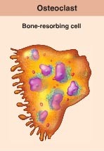 <p>Hemopoietic stem cells merge to become osteoclasts, they have numerous amounts of nuclei.</p><ul><li><p>Osteoblasts send them signals in order to stay alive, if not they perform cell death / apoptosis.</p></li><li><p>When active, cells are located in depressions called reabsorption bays.</p></li><li><p>Function in bone resorption.</p></li><li><p>Cells have ruffled borders that serve to increase surface area.</p></li><li><p>Addition of acid to ionize calcium phosphate in bone matrix.</p></li></ul>