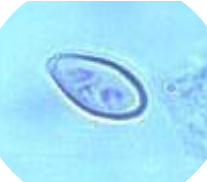 <ul><li><p>27-35 x 14-16 um</p></li><li><p><u>Urn shaped</u></p></li><li><p><u>Seated/shoulder operculum</u></p></li><li><p>Small knob on aboperculum end</p></li></ul><p></p>