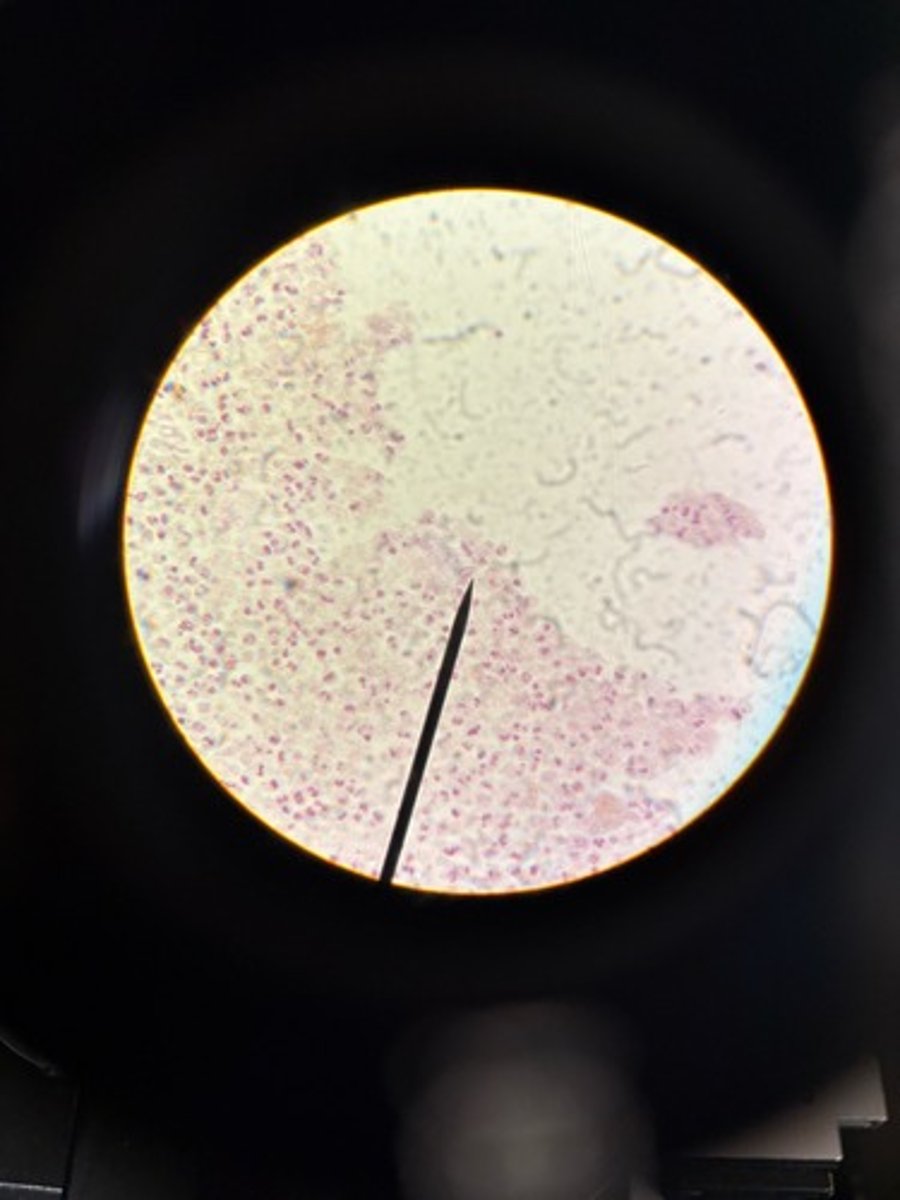 <p>Identify</p>