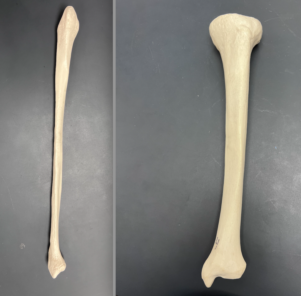 <p>fibula</p>